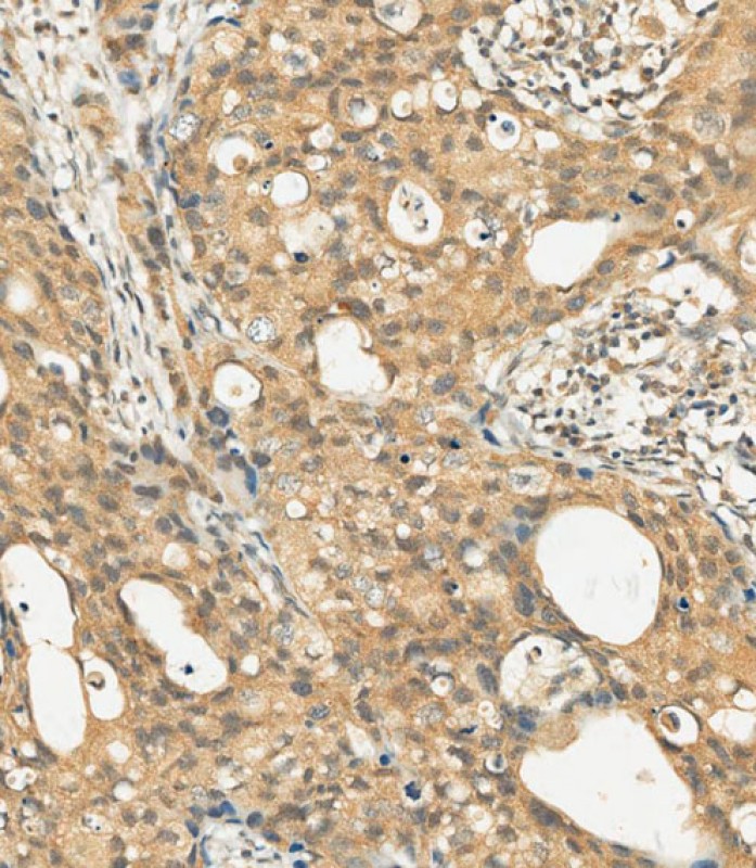 IHC-P - c-KIT Antibody (C-term) AP7656b